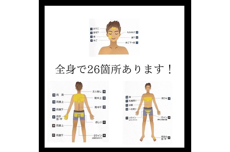 EB8F4C81-262A-4460-ABF4-9B8AF073DF1C