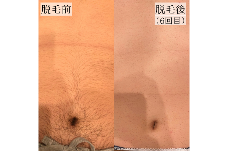 4A29A865-DE3B-4BC9-9062-C4D88945D2D6